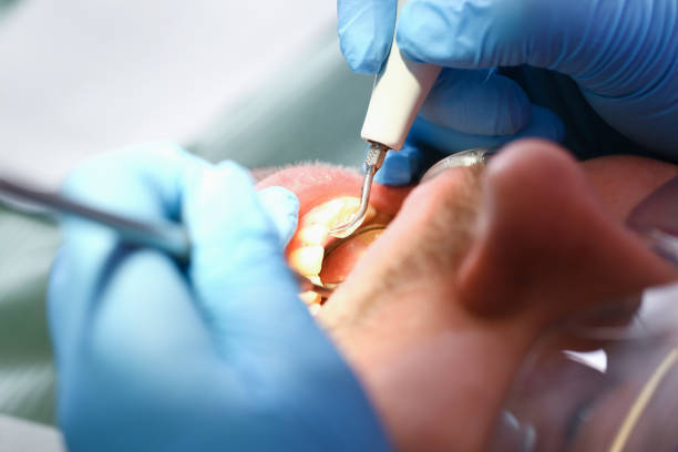 Best Broken or Cracked Tooth Emergency Dentist in Tamaqua, PA
