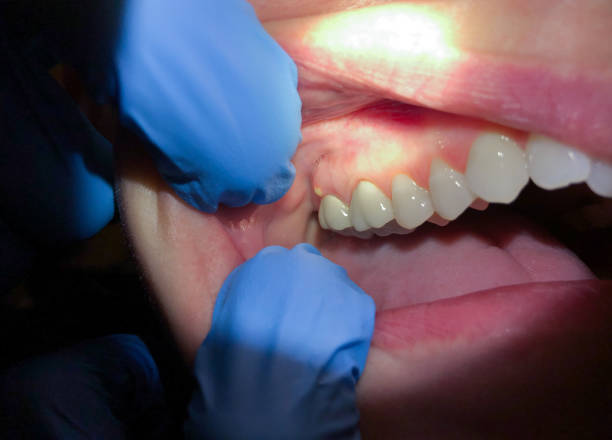 Best Weekend Emergency Dentist in Tamaqua, PA